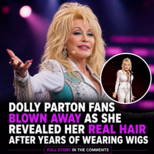 Dolly Parton stunned fans as she revealed her real hair after years of wearing wigs
